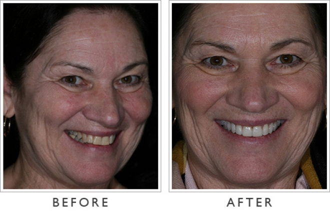 Try this: How to get porcelain white skin