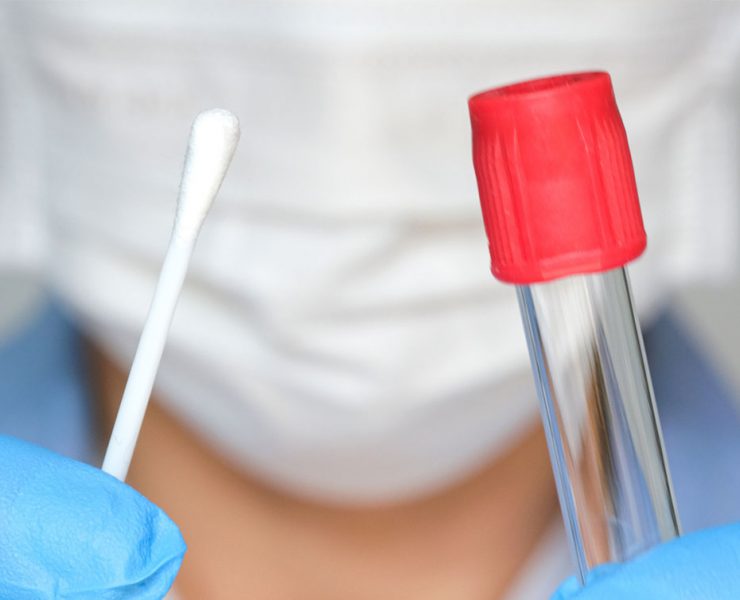 A provider holding a cotton swap and a vial to perform a patient's COVID-19 testing.